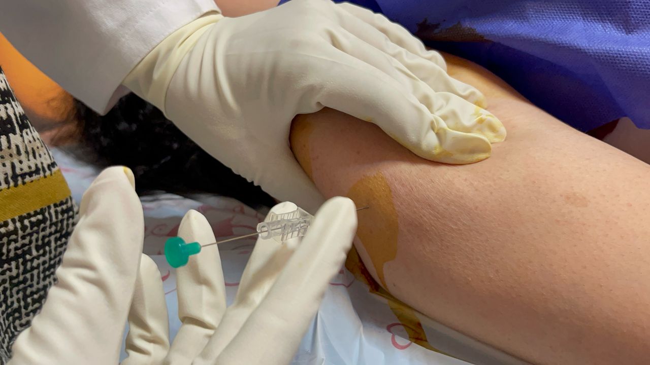 امبدینگ بازو چیست؟