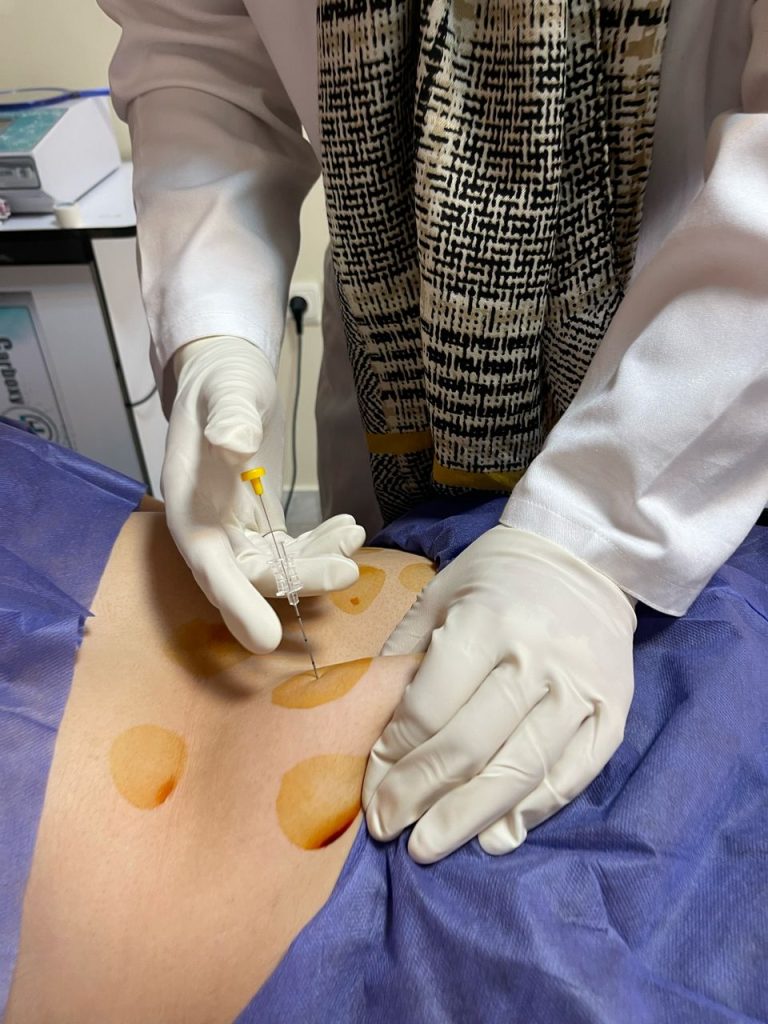 امبدینگ شکم و پهلو