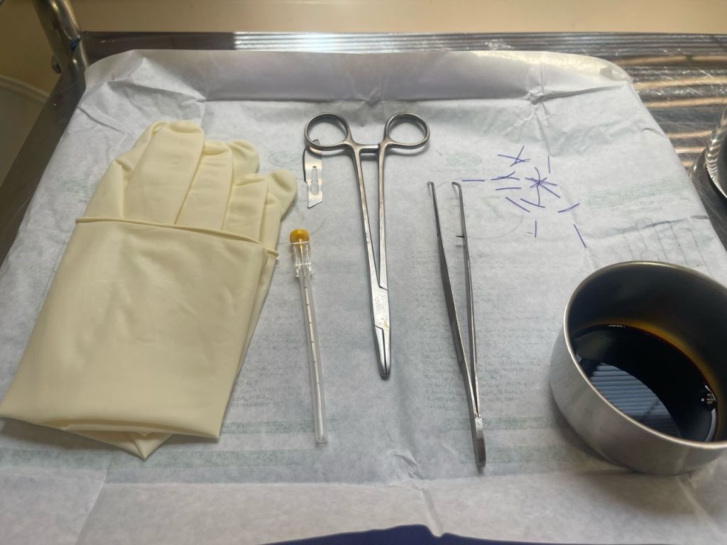 چرا لاغری با طب سوزنی