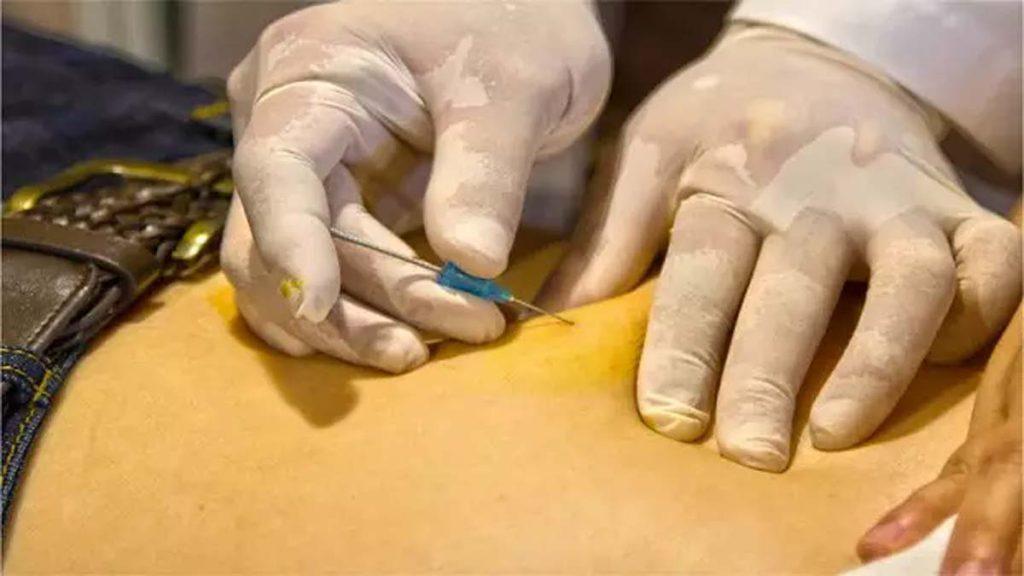 امبدینگ یا کاشت نخ چیست؟