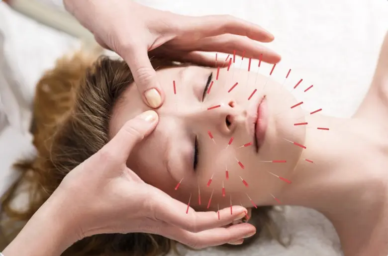 طب سوزنی چگونه عمل می کند؟