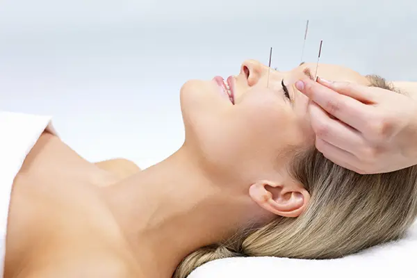 طب سوزنی برای میگرن و کاهش دردهای میگرنی