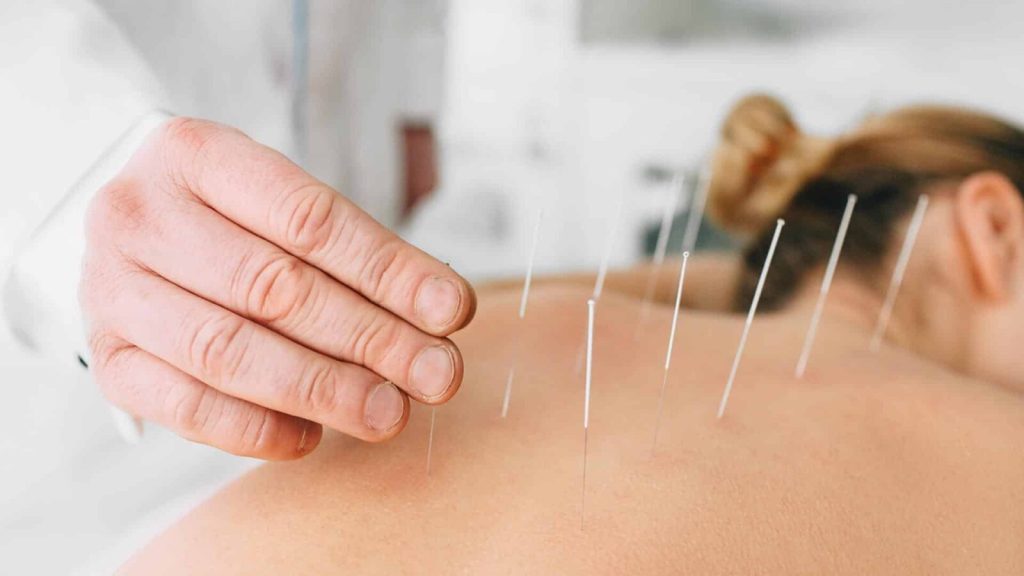 طب سوزنی چیست؟ همه چیز درباره فواید، کاربردها و عوارض طب سوزنی
